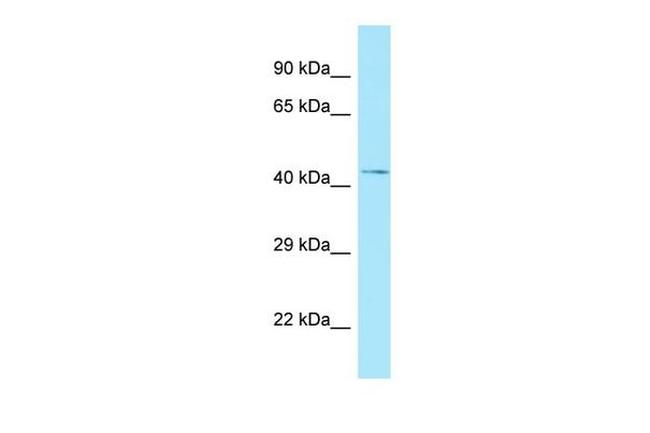 NADK Antibody in Western Blot (WB)