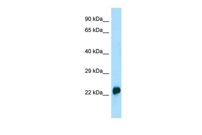 CRYGA Antibody in Western Blot (WB)
