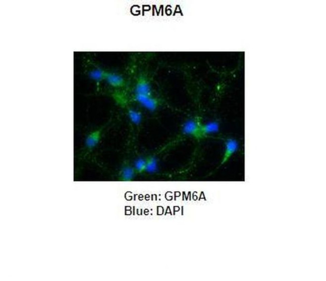 GPM6A Antibody in Immunohistochemistry (IHC)