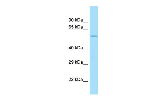 C7orf28A Antibody in Western Blot (WB)