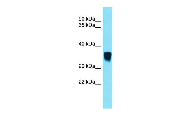 SNX15 Antibody in Western Blot (WB)