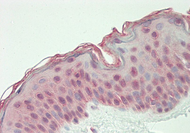 GLTSCR1 Antibody in Immunohistochemistry (Paraffin) (IHC (P))