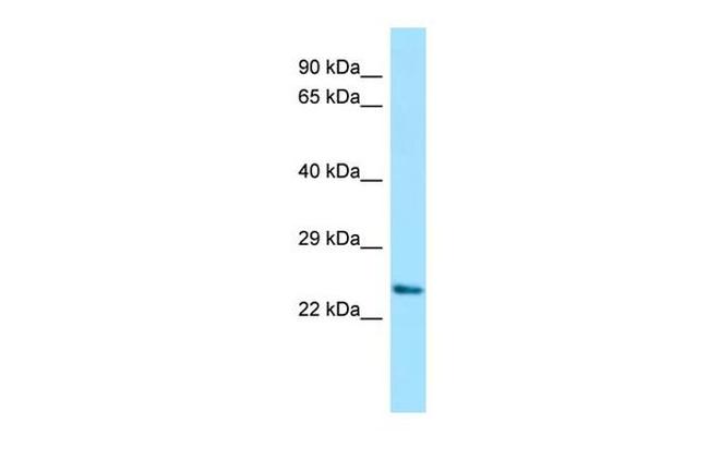 DPRX Antibody in Western Blot (WB)
