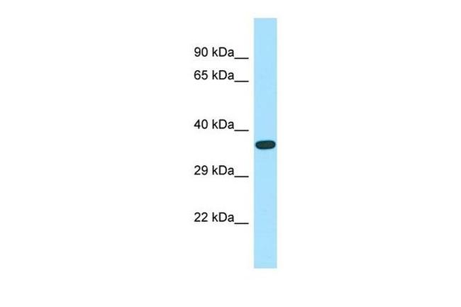 ASB14 Antibody in Western Blot (WB)