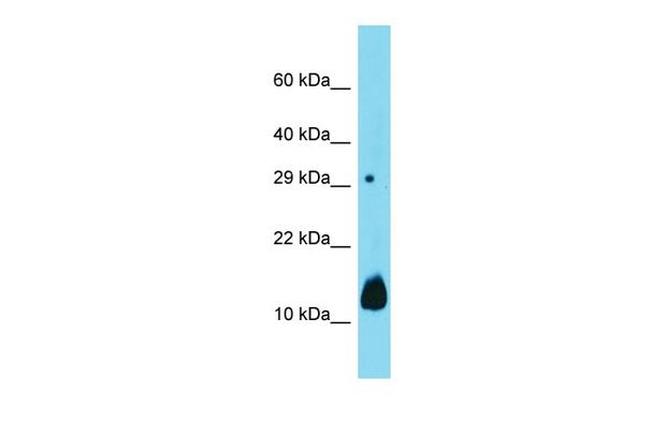 DUSP15 Antibody in Western Blot (WB)