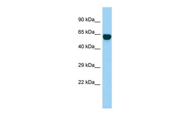SYT14 Antibody in Western Blot (WB)