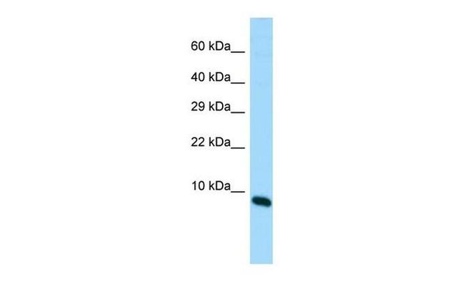 MIR22HG Antibody in Western Blot (WB)