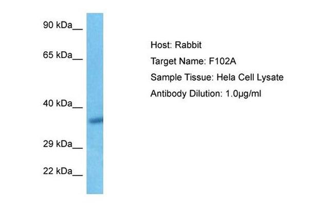 FAM102A Antibody in Western Blot (WB)