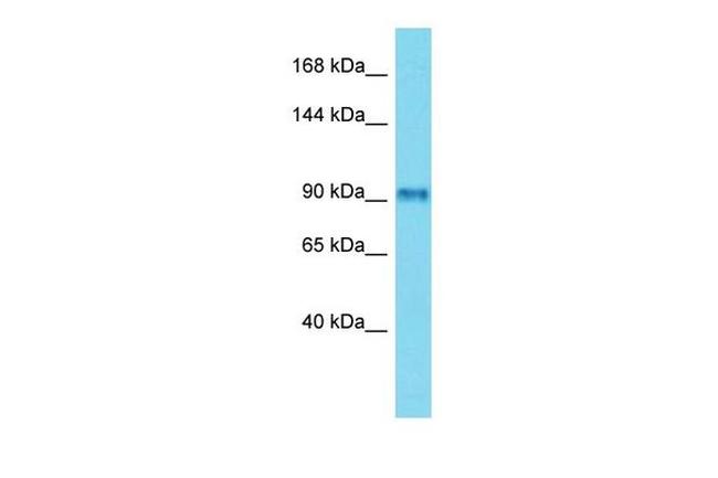 FSIP2 Antibody in Western Blot (WB)