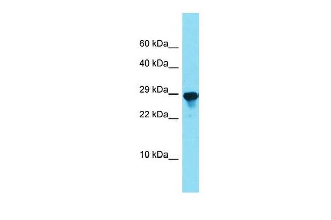 SPCS2 Antibody in Western Blot (WB)
