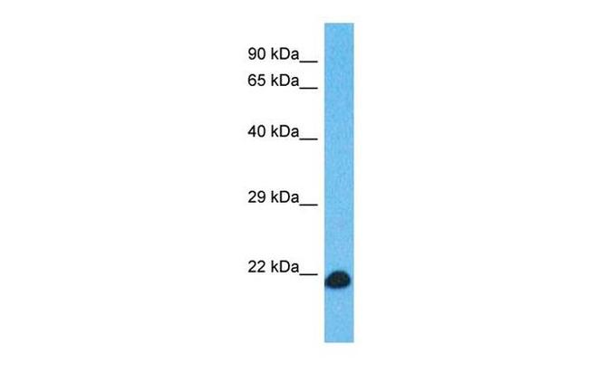C6orf163 Antibody in Western Blot (WB)