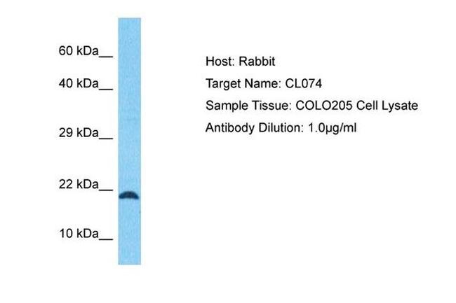 C12orf74 Antibody in Western Blot (WB)