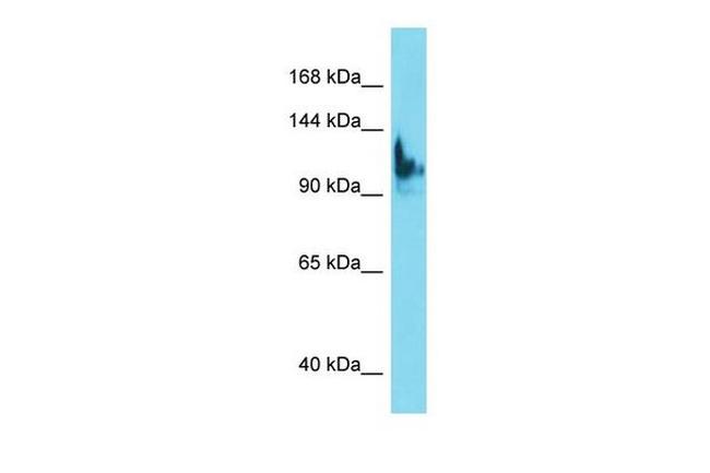 SKIDA1 Antibody in Western Blot (WB)