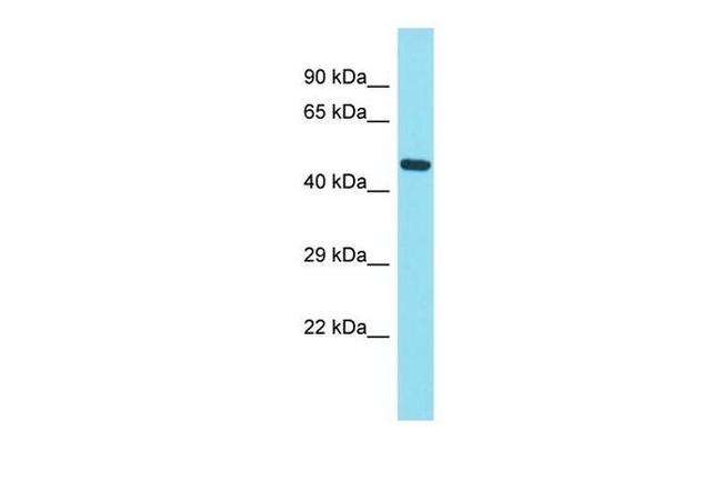 FAM221B Antibody in Western Blot (WB)