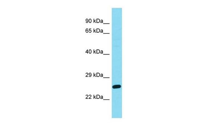 DIRAS2 Antibody in Western Blot (WB)