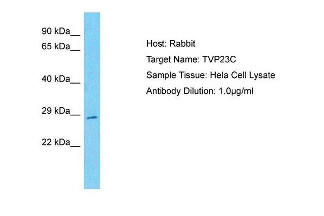 TVP23C Antibody in Western Blot (WB)