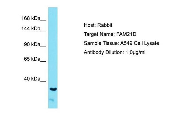 FAM21A Antibody in Western Blot (WB)