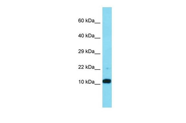 FAM25A Antibody in Western Blot (WB)