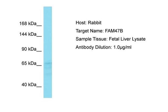 FAM47B Antibody in Western Blot (WB)