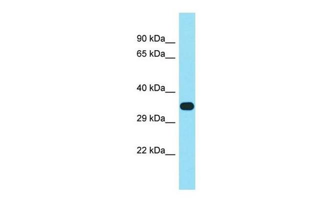F102B Antibody in Western Blot (WB)