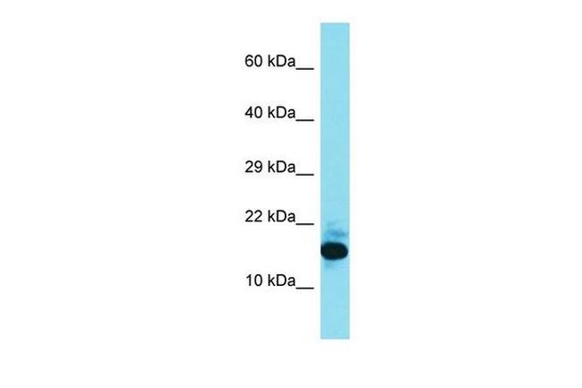 FAM177B Antibody in Western Blot (WB)