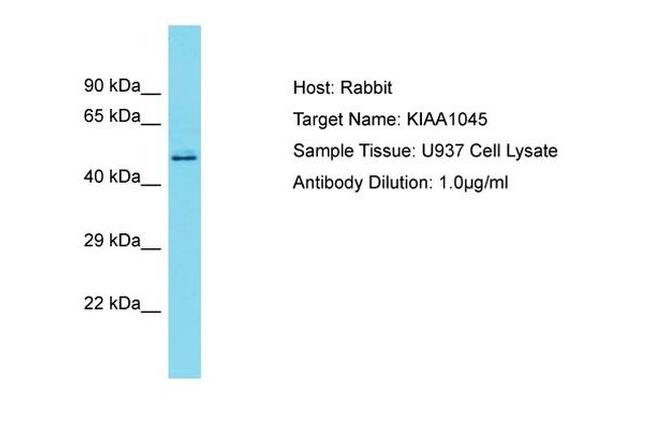 KIAA1045 Antibody in Western Blot (WB)