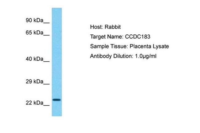 CCDC183 Antibody in Western Blot (WB)