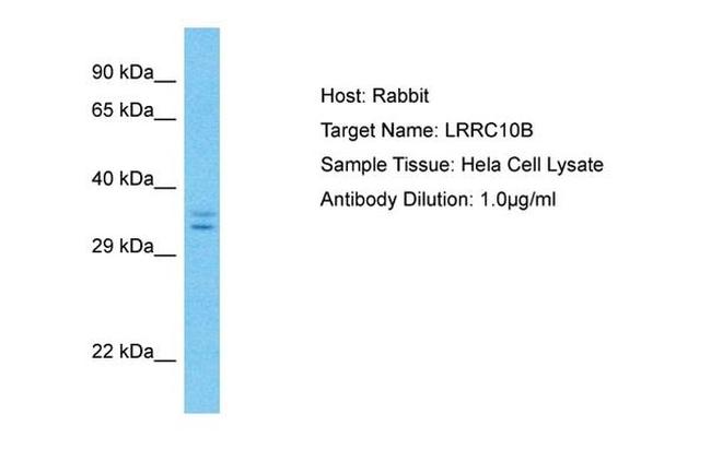 LRRC10B Antibody in Western Blot (WB)