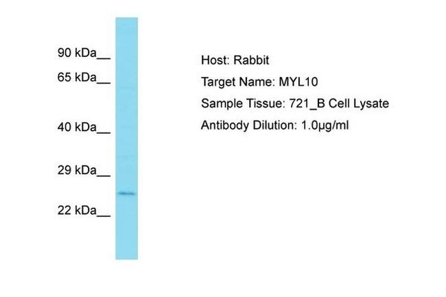 MYL10 Antibody in Western Blot (WB)