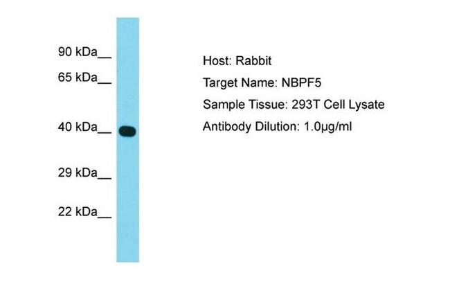 NBPF5P Antibody in Western Blot (WB)