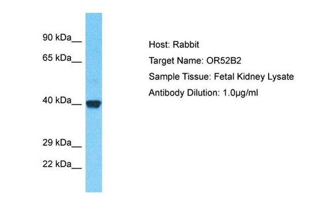 OR52B2 Antibody in Western Blot (WB)