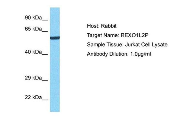 REXO1L2P Antibody in Western Blot (WB)