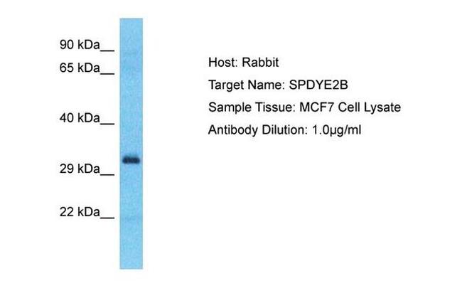 SPDYE2B Antibody in Western Blot (WB)