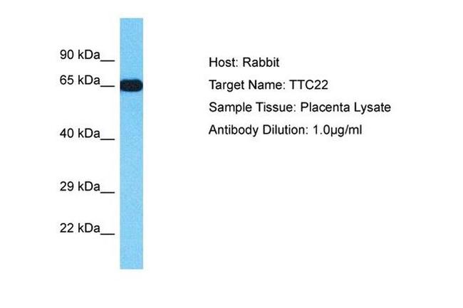 TTC22 Antibody in Western Blot (WB)