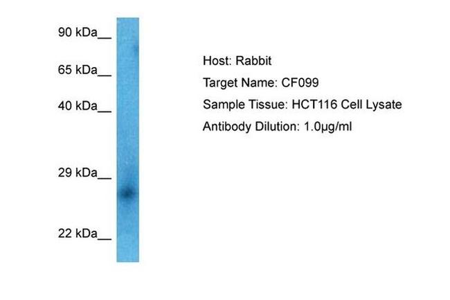C6orf99 Antibody in Western Blot (WB)