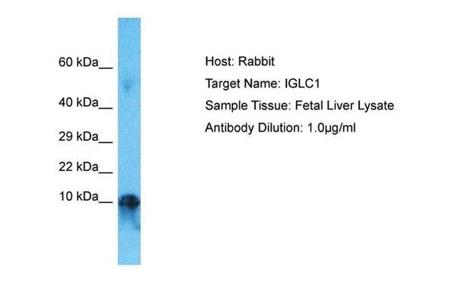 Lambda light chain Antibody in Western Blot (WB)