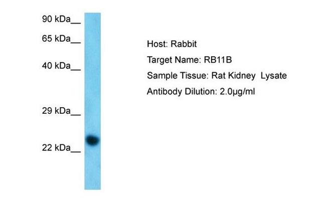 RAB11B Antibody in Western Blot (WB)