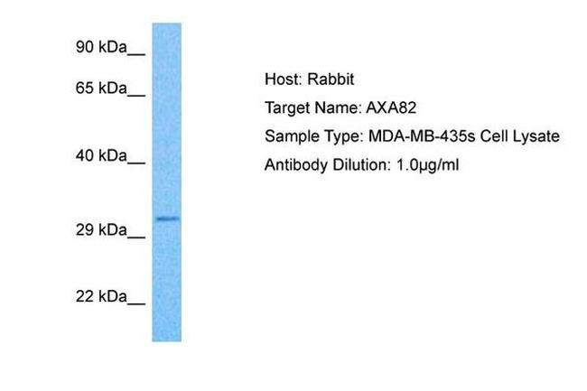 ANXA8L1 Antibody in Western Blot (WB)