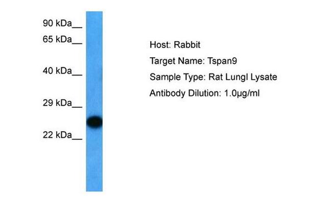 TSPAN9 Antibody in Western Blot (WB)