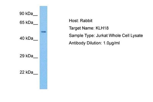 KLH18 Antibody in Western Blot (WB)