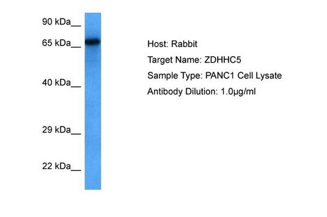 ZDHHC5 Antibody in Western Blot (WB)