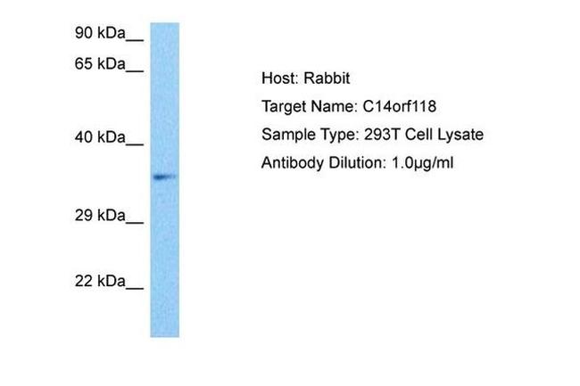 GPATCH2L Antibody in Western Blot (WB)