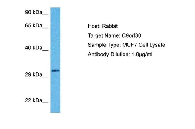 MSANTD3 Antibody in Western Blot (WB)