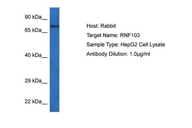 KF1 Antibody in Western Blot (WB)