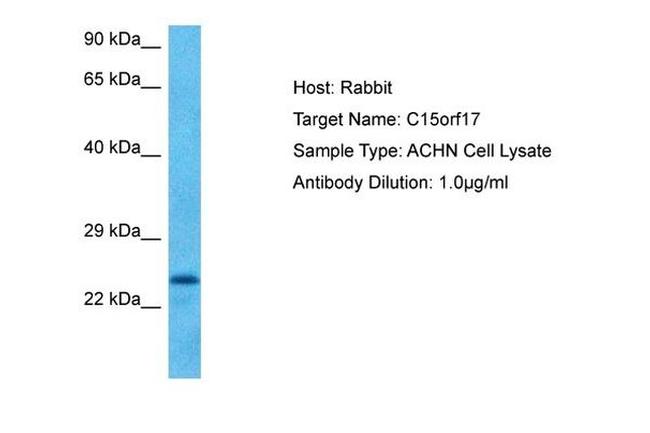 FAM219B Antibody in Western Blot (WB)