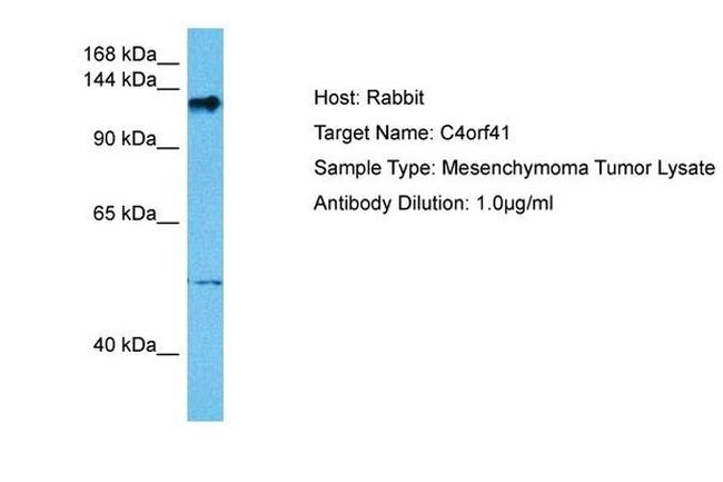 C4ORF41 Antibody in Western Blot (WB)