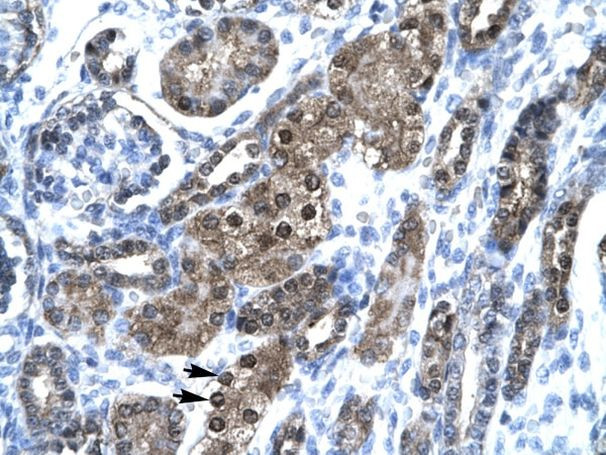 SNAPC2 Antibody in Immunohistochemistry (IHC)