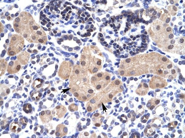 SNAPC2 Antibody in Immunohistochemistry (IHC)