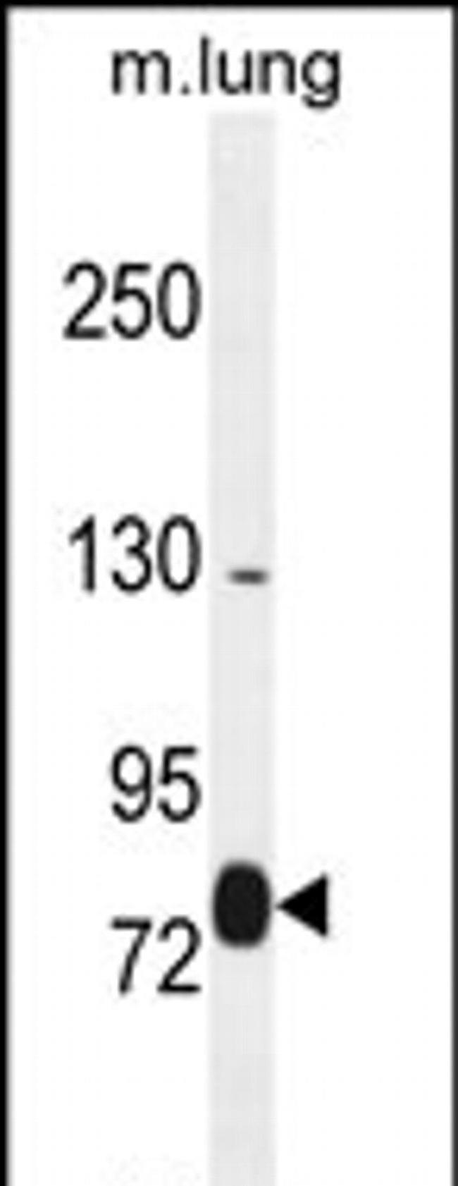 EXOC8 Antibody in Western Blot (WB)