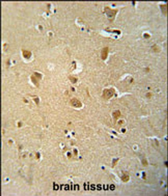 WWC3 Antibody in Immunohistochemistry (IHC)